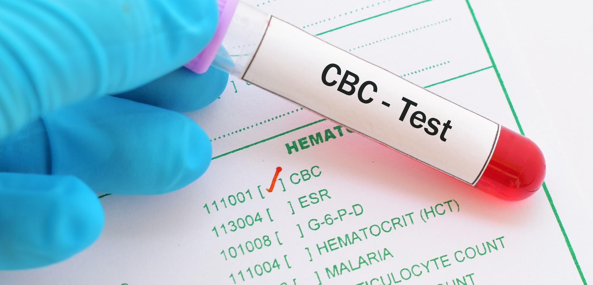 Complete Blood Count (CBC) with ESR