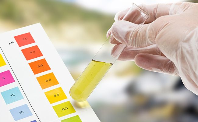 Urine R/M/E (Routine & Microscopic Examination)