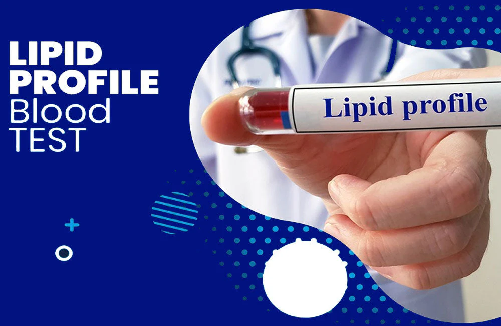 Fasting Lipid Profile